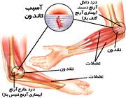 پاورپوینت آسیب های آرنج